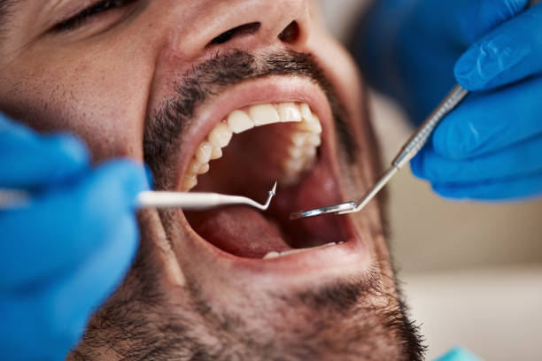 Emergency Gum Pain Relief in MT