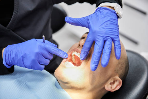 Best Knocked-Out Tooth Emergency  in Frenchtown, MT